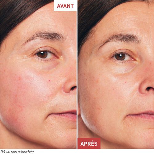 Skin Therapy - Huile-Sérum Nuit