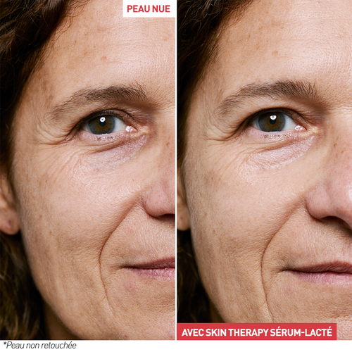 Skin Therapy - Sérum Lacté Nuit