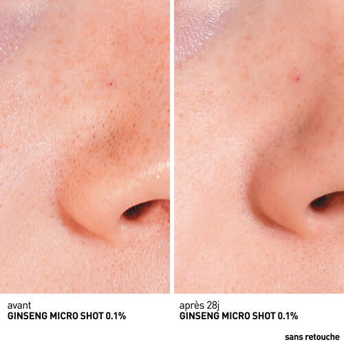 Sérum Ginseng Micro Shot Starter